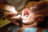 Самые распространенные зубные заболевания