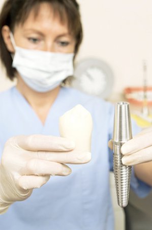 Имплантаты в стоматологии