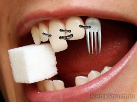 Искусственные зубы не будут выбиваться из ряда