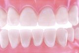 Отбеливание зубов в домашних условиях	