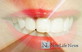 Отбеливание зубов эффективность