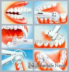 Как чистить зубы электрической щеткой