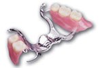 Фиксация зубных съемных протезов