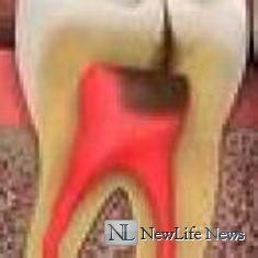 Что такое пульпа зуба?