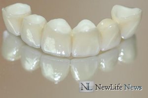 Уход за зубами из металлокерамики