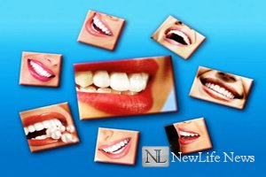 Как отбелить зубы без вреда?