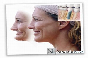  Восстановление утраченных зубов
