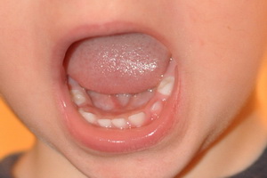 Сколько зубов в 4 года?