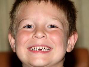Сколько зубов в 6 лет?