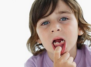 Сколько молочных зубов у детей
