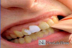 Как отбелить желтые зубы?