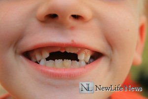 Какие зубы меняются у детей?