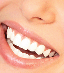 Чем отбелить зубы в домашних условиях?