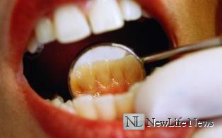 Регулярное посещение стоматолога – залог здоровья ваших зубов 